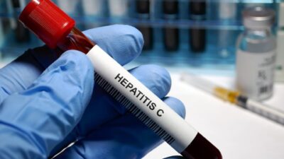 Hepatitis C