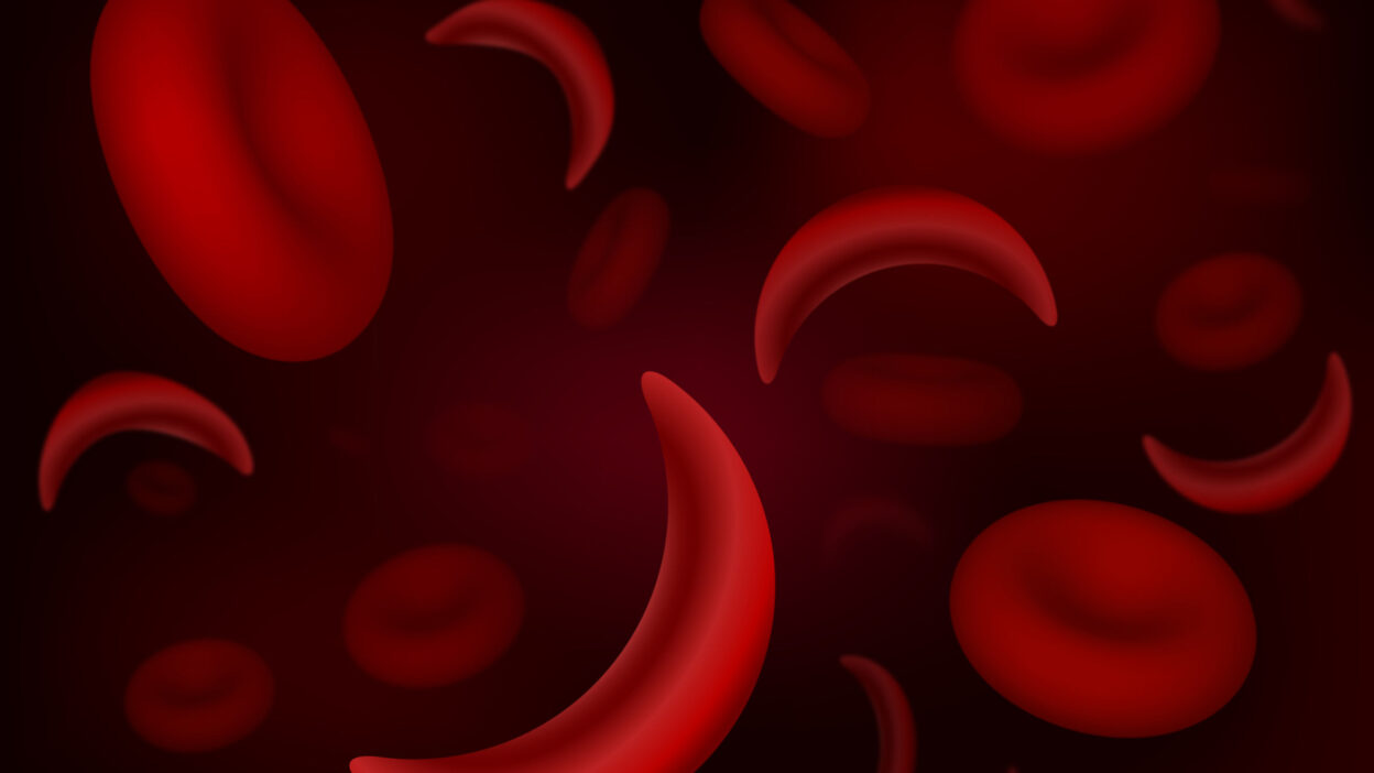 Understanding Sickle Cell Disease and the Importance of Genotype Testing