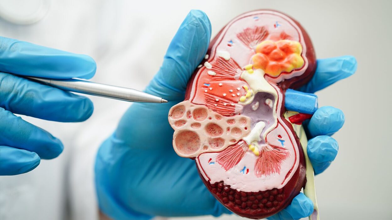 Early Signs of Kidney Disease