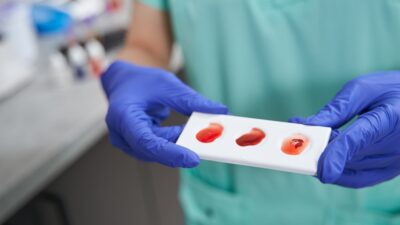 doctor doing blood typing