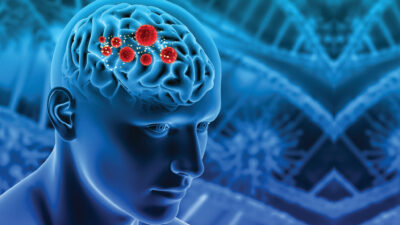 Meningitis