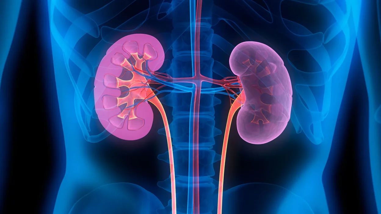 Kidney Disease in Nigeria